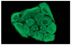 Cytokeratin 8/18 (NCL-5D3): sc-52325. Immunofluorescence staining of ethanol-fixed HeLa cells showing cytoskeletal localization.