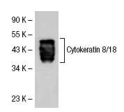 Cytokeratin 8/18 (NCL-5D3): sc-52325. Western blot analysis of Cytokeratin 8/18 expression in MCF7 whole cell lysate.