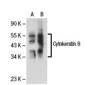 Cytokeratin 8/18 (NCL-5D3): sc-52325. Western blot analysis of Cytokeratin 8 expression in non-transfected: sc-117752 (A) and human Cytokeratin 8 transfected: sc-113509 (B) 293T whole cell lysates.