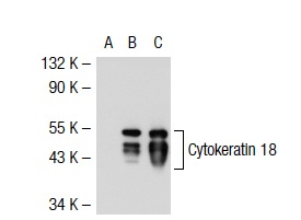 Cytokeratin 8/18 (NCL-5D3): sc-52325. Western blot analysis of Cytokeratin 18 expression in non-transfected 293: sc-110760 (A), human Cytokeratin 18 transfected 293: sc-110494 (B) and HeLa (C) whole cell lysates.