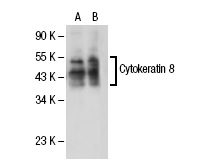 Cytokeratin 8/18 (0.N.352): sc-70939. Western blot analysis of Cytokeratin 8 expression in non-transfected: sc-117752 (A) and human Cytokeratin 8 transfected: sc-113509 (B) 293T whole cell lysates.