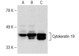 Cytokeratin 19 (A53-B/A2): sc-6278. Western blot analysis of Cytokeratin 19 expression in MCF7 (A), MIA PaCa-2 (B) and MDA-MB-231 (C) whole cell lysates.