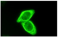 pan-Cytokeratin (H-240): sc-15367. Immunofluorescence staining of methanol-fixed HeLa cells showing cyto-skeletal localization.