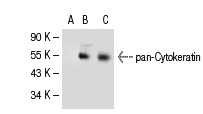 pan-Cytokeratin (H-240): sc-15367. Western blot analysis of pan-Cytokeratin expression in non-transfected 293T: sc-117752 (A), human Cytokeratin 10 transfected 293T: sc-113858 (B) and HeLa (C) whole cell lysate.