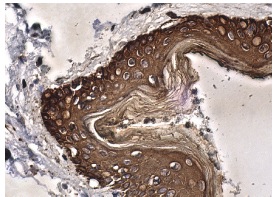 pan-Cytokeratin (H-240): sc-15367. Immunoperoxidase staining of formalin fixed, paraffin-embedded human skin tissue showing cytoplasmic staining of epidermal cells.