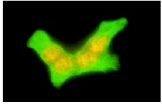 pan-Cytokeratin (C11): sc-8018. Immunofluorescence staining of methanol-fixed A-431 cells showing cytoskeletal fluorescein immunostaining of Cytokeratin proteins. Note also nuclear rhodamine immunostaining with p53 (FL-393): sc-6243.