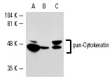 pan-Cytokeratin (C11): sc-8018. Western blot analysis of Cytokeratin protein expression in MCF7 (A), HeLa (B) and A-431 (C) whole cell lysates.