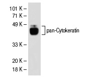 pan-Cytokeratin (C11): sc-8018. Western blot analysis of pan-Cytokeratin expression in HeLa whole cell lysate.
