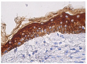 pan-Cytokeratin (C11): sc-8018. Immunoperoxidase staining of formalin fixed, paraffin-embedded human skin tissue showing cytoplasmic staining of keratinocytes.