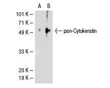 pan-Cytokeratin (D-12): sc-17843. Western blot analysis of pan-Cytokeratin expression in non-transfected: sc-117752 (A) and human Cytokeratin 10 transfected: sc-113858 (B) 293T whole cell lysates.