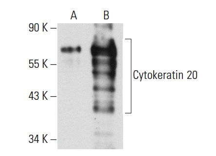 pan-Cytokeratin (PK110): sc-53403. Western blot analysis of Cytokeratin 20 expression in non-transfected: sc-117752 (A) and human Cytokeratin 20 transfected: sc-174535 (B) 293T whole cell lysates.