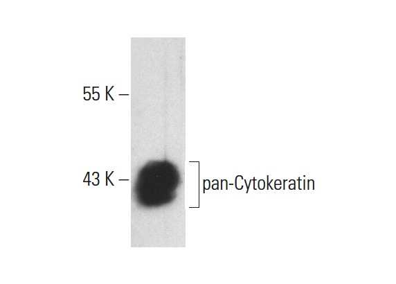 pan-Cytokeratin (PK63): sc-53406. Western blot analysis of pan-Cytokeratin expression in HeLa whole cell lysate.