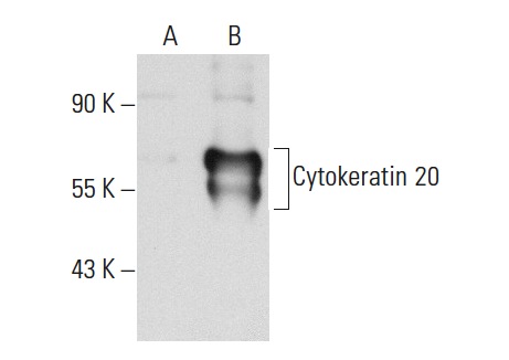 pan-Cytokeratin (PK63): sc-53406. Western blot analysis of Cytokeratin 20 expression in non-transfected: sc-117752 (A) and human Cytokeratin 20 transfected: sc-174535 (B) 293T whole cell lysates.