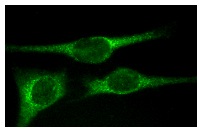Desmin (H-76): sc-14026. Immunofluorescence staining of methanol-fixed Sol8 cells showing cytoplasmic localization.