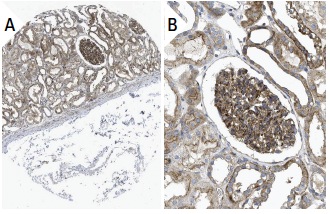 Dynactin p62 (H-4): sc-55603. Immunoperoxidase staining of formalin fixed, paraffin-embedded human kidney tissue showing cytoplasmic staining of cells in glomeruli and tubules (low and high magnification). Kindly provided by The Swedish Human Protein Atlas (HPA) program.