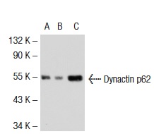 Dynactin p62 (H-4): sc-55603. Western blot analysis of Dynactin p62 expression in non-transfected 293T: sc-117752 (A), mouse Dynactin p62 transfected 293T: sc-119870 (B) and BC3H1 (C) whole cell lysates.