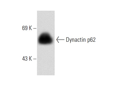 Dynactin p62 (H-4): sc-55603. Western blot analysis of Dynactin p62 expression in RAW 264.7 whole cell lysate.
