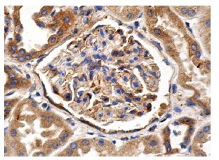 Dynactin p62 (H-4): sc-55603. Immunoperoxidase staining of formalin fixed, paraffin-embedded human pancreas tissue showing cytoplasmic staining of Islets of Langerhans and glandular cells.