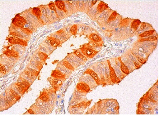 DYNLL1/2 (FL-89): sc-13969. Immunoperoxidase staining of formalin fixed, paraffin-embedded human fallopian tube tissue showing cytoplasmic and nuclear staining of glandular cells.