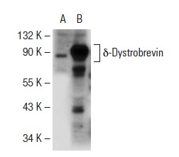 Dystrobrevin (K-18): sc-13818. Western blot analysis of δ-Dystrobrevin expression in non-transfected: sc-117752 (A) and human δ-Dystrobrevin transfected: sc-177157 (B) 293T whole cell lysates.