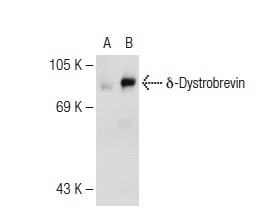 Dystrobrevin (V-19): sc-13812. Western blot analysis of δ-Dystrobrevin expression in non-transfected: sc-110760 (A) and human δ-Dystrobrevin transfected: sc-177159 (B) 293 whole cell lysates.