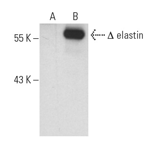 elastin (E-11): sc-166543. Western blot analysis of elastin expression in non-transfected: sc-117752 (A) and truncated human elastin transfected: sc-117067 (B) 293T whole cell lysates.