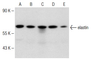 elastin (E-11): sc-166543. Western blot analysis of elastin expression in MES-SA/Dx5 (A), MIA PaCa-2 (B), SHP-77 (C), H69AR (D) and A549 (E) whole cell lysates.