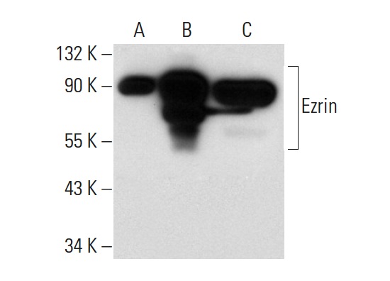 Ezrin (C-19): sc-6407. Western blot analysis of Ezrin expression in non-transfected 293T: sc-117752 (A), human Ezrin transfected 293T: sc-170691 (B) and Ramos (C) whole cell lysates.