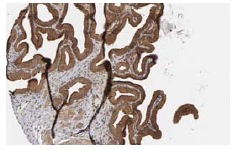 γ Tubulin (C-11): sc-17787. Immunoperoxidase staining of formalin fixed, paraffin-embedded human gall bladdertissue showing cytoplasmic staining of glandular cells. Kindly provided by The Swedish Human Protein Atlas (HPA) program.