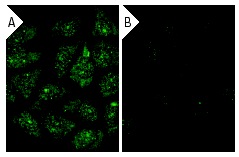 γ Tubulin siRNA (h): sc-29322. Immunofluorescence staining of methanol-fixed, control HeLa (A) and γ Tubulin siRNA silenced HeLa (B) cells showing diminished cytoplasmic and nuclear staining in the siRNA silenced cells. Cells probed with γ Tubulin (C-11): sc-17787.