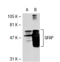 GFAP (2E1): sc-33673. Western blot analysis of GFAP expression in non-transfected: sc-117752 (A) and human GFAP transfected: sc-115582 (B) 293T whole cell lysates.