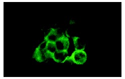 KLC1 (H-75): sc-25735. Immunofluorescence staining of methanol-fixed IMR-32 cells showing cytoplasmic localization.