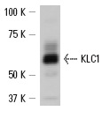 KLC1 (H-75): sc-25735. Western blot analysis of KLC1 expression in IMR-32 whole cell lysate.