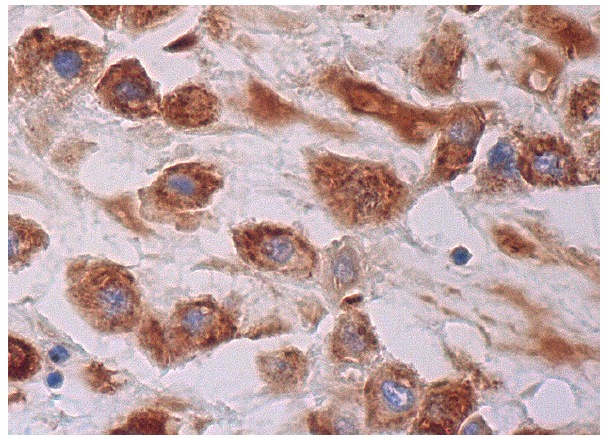 KLC1 (H-75): sc-25735. Immunoperoxidase staining of formalin fixed, paraffin-embedded human placenta tissue showing cytoplasmic staining of decidual cells.
