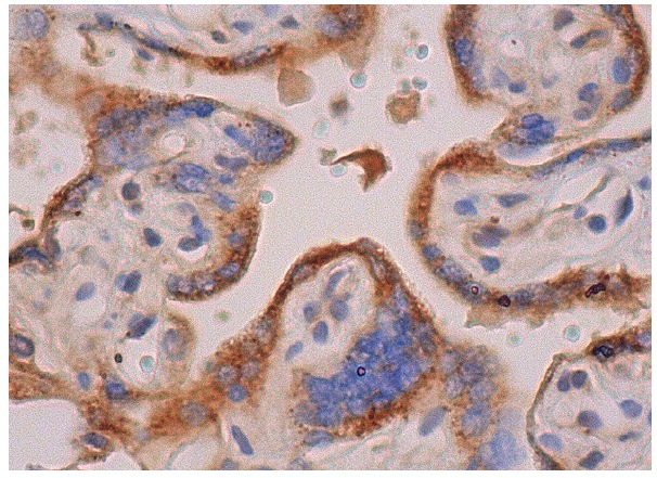 KLC1 (H-75): sc-25735. Immunoperoxidase staining of formalin fixed, paraffin-embedded human placenta tissue showing cytoplasmic staining of trophoblastic cells.