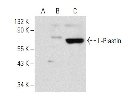 L-Plastin (B-9): sc-133218. Western blot analysis of L-Plastin expression in non-transfected 293T: sc-117752 (A), human L-Plastin transfected 293T: sc-159508 (B) and CCRF-CEM (C) whole cell lysates.