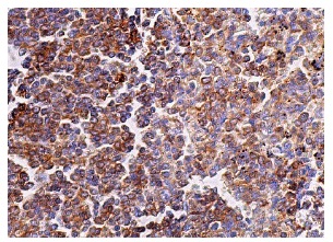 L-Plastin (B-9): sc-133218. Immunoperoxidase staining of formalin fixed, paraffin-embedded human spleen tissue showing cytoplasmic staining of cells in white and red pulps.