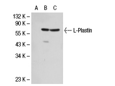 L-Plastin (D-16): sc-16657. Western blot analysis of L-Plastin expression in non-transfected 293T: sc-117752 (A), human L-Plastin transfected 293T: sc-113499 (B) and CCRF-CEM (C) whole cell lysates.