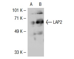 LAP2 (H-130): sc-28541. Western blot analysis of LAP2 expression in non-transfected: sc-117752 (A) and human LAP2 transfected: sc-116552 (B) 293T whole cell lysates.