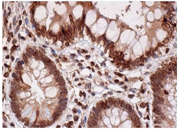 LAP2 (H-130): sc-28541. Immunoperoxidase staining of formalin fixed, paraffin-embedded human small intestine tissue showing nuclear envelope, nuclear and cytoplasmic staining of glandular cells.