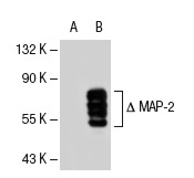 MAP-2 (A-4): sc-74421. Western blot analysis of MAP-2 expression in non-transfected: sc-117752 (A) and truncated mouse MAP-2 transfected: sc-121505 (B) 293T whole cell lysates.