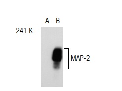 MAP-2 (A-4): sc-74421. Western blot analysis of MAP-2 expression in non-transfected: sc-117752 (A) and human MAP-2 transfected: sc-115536 (B) 293T whole cell lysates.