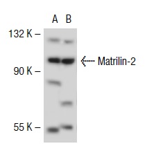 Matrilin-2 (H-65): sc-66959. Western blot analysis of Matrilin-2 expression in non-transfected: sc-117752 (A) and mouse Matrilin-2 transfected: sc-121529 (B) 293T whole cell lysates.