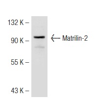 Matrilin-2 (H-65): sc-66959. Western blot analysis of Matrilin-2 expression in Jurkat whole cell lysate.