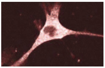 Mena (21): sc-135988. Immunofluorescence staining of A-431 cells showing cell junction and cytoplasmic localization.