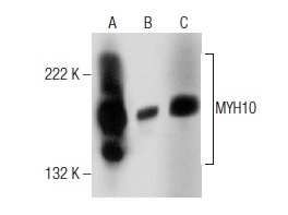 MYH10 (A-5): sc-376954. Western blot analysis of MYH10 expression in IMR-32 whole cell lysate (A) and mouse brain (B) and rat brain (C) tissue extracts.