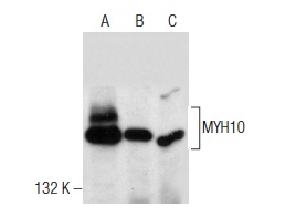 MYH10 (A-5): sc-376954. Western blot analysis of MYH10 expression in IMR-32 whole cell lysate (A) and mouse brain (B) and rat brain (C) tissue extracts.