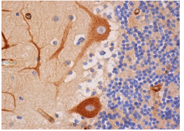 MYH10 (A-5): sc-376954. Immunoperoxidase staining of formalin fixed, paraffin-embedded human cerebellum tissue showing cytoplasmic staining of perkinje cells and neurofilaments.