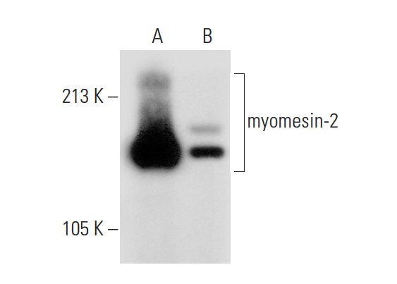 myomesin-2 (H-16): sc-30385. Western blot analysis of myomesin-2 expression in rat skeletal muscle (A) and rat heart (B) tissue extracts.