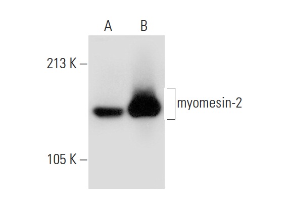 myomesin-2 (H-16): sc-30385. Western blot analysis of myomesin-2 expression in mouse heart (A) and mouse skeletal muscle (B) tissue extracts.